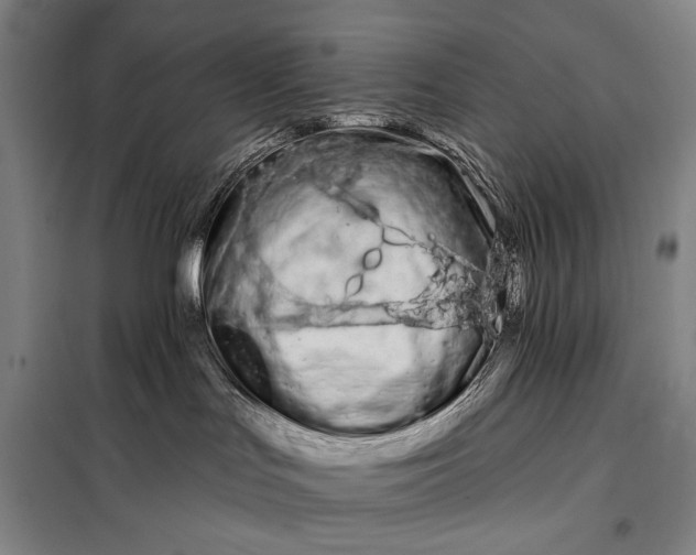 X0000098130047200805011330