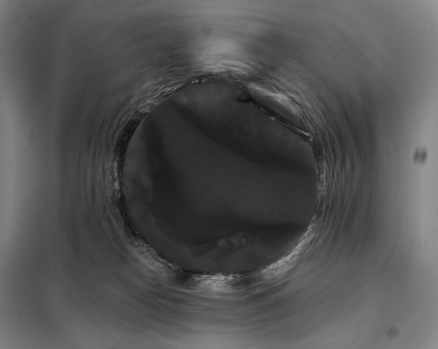 X0000098130182200805011329