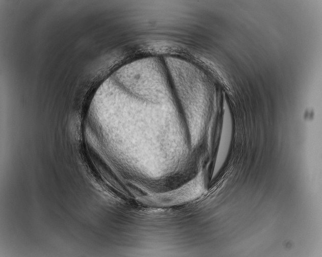 X0000098130453200805011325
