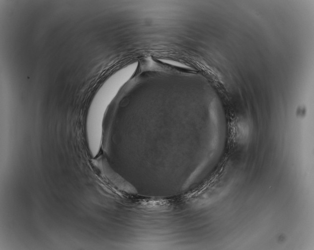 X0000098130517200805011324