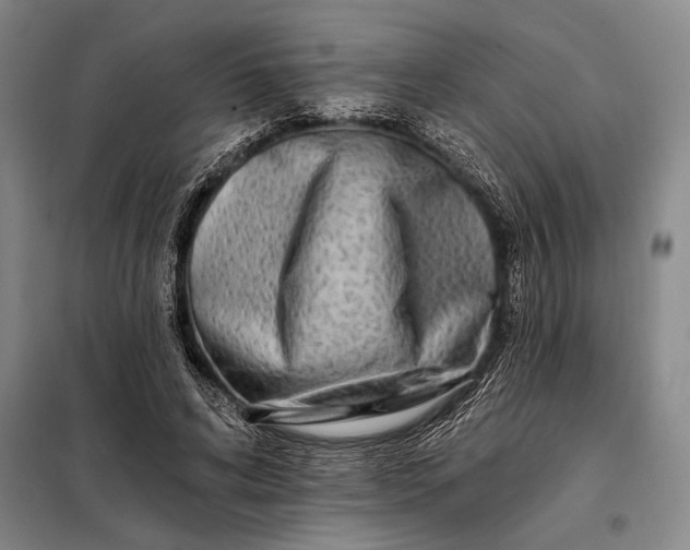 X0000098130592200805011323