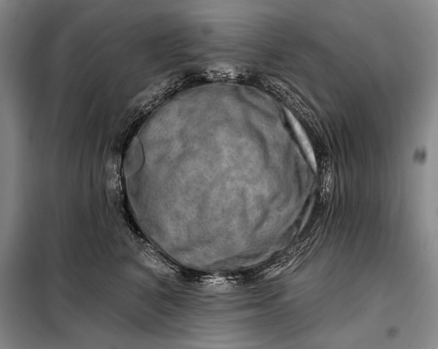 X0000098130616200805011322