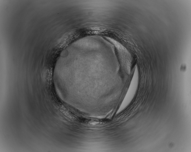 X0000098130657200805011322