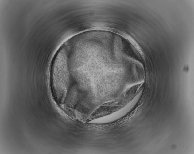 X0000098130955200805011318