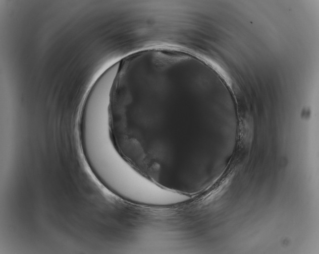 X0000098131007200805011317