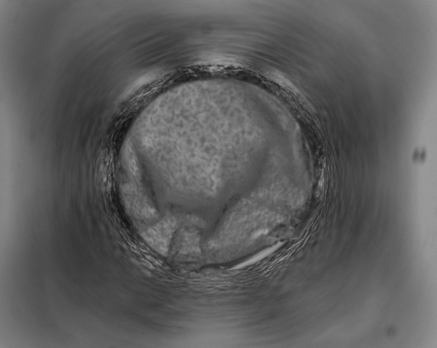 X0000098131014200805011316