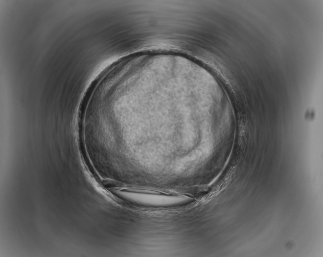 X0000098131038200805011317