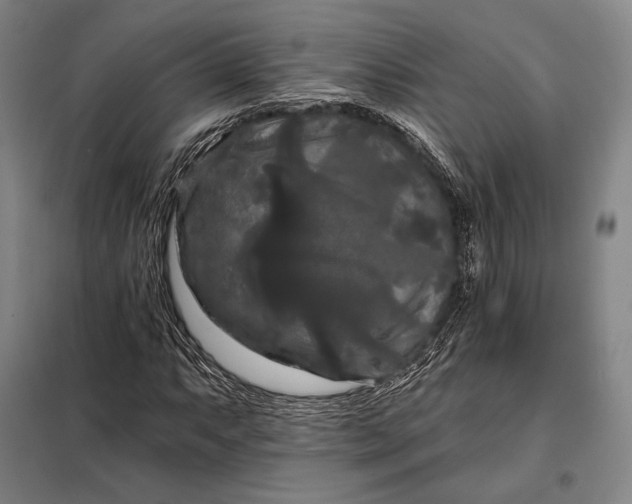 X0000098131063200805011316