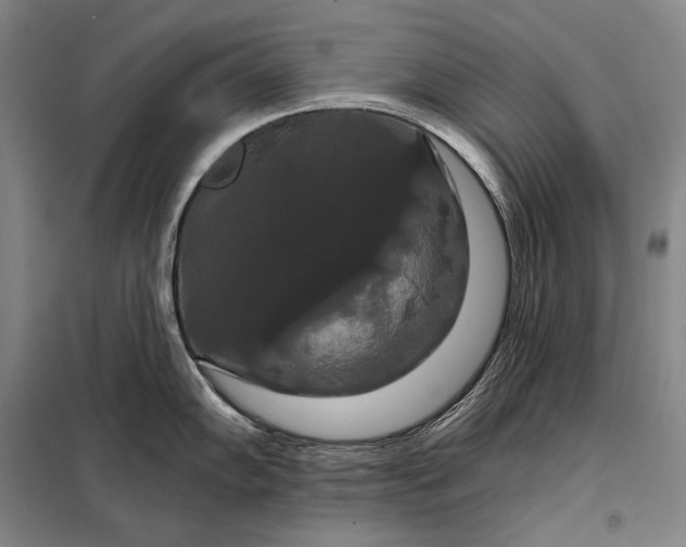 X0000098131102200805011316