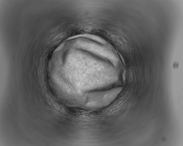 X0000098131105200805011315