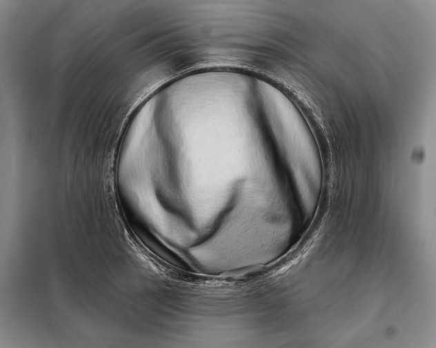 X0000098131137200805011315