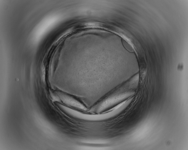 X0000098131151200805011316
