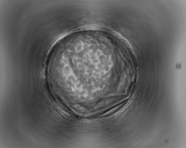 X0000098131166200805011315