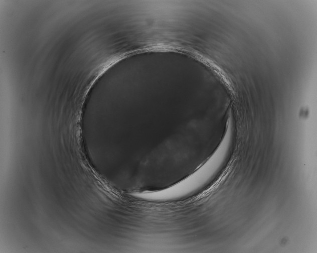 X0000098131170200805011315