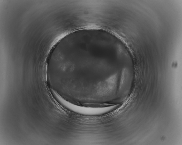 X0000098131171200805011315