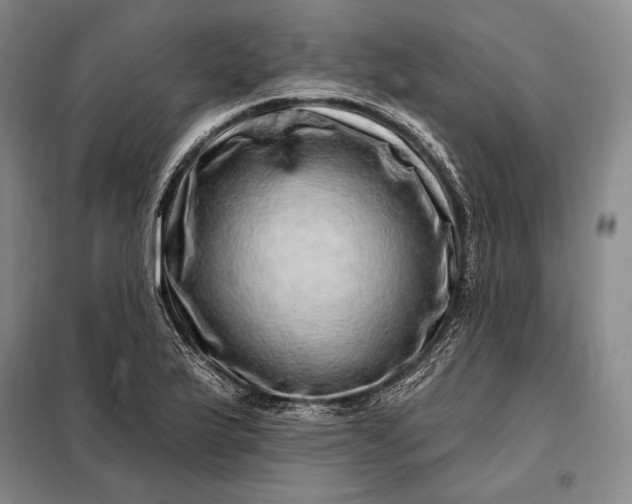 X0000098131175200805011314