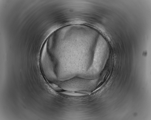 X0000098131186200805011314