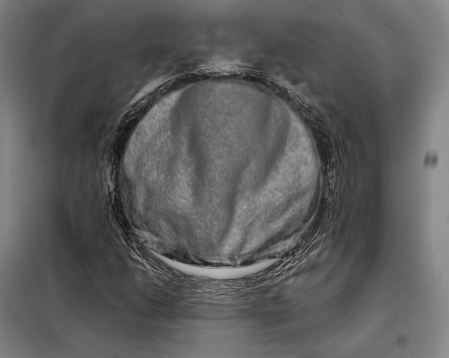 X0000098131206200805011314