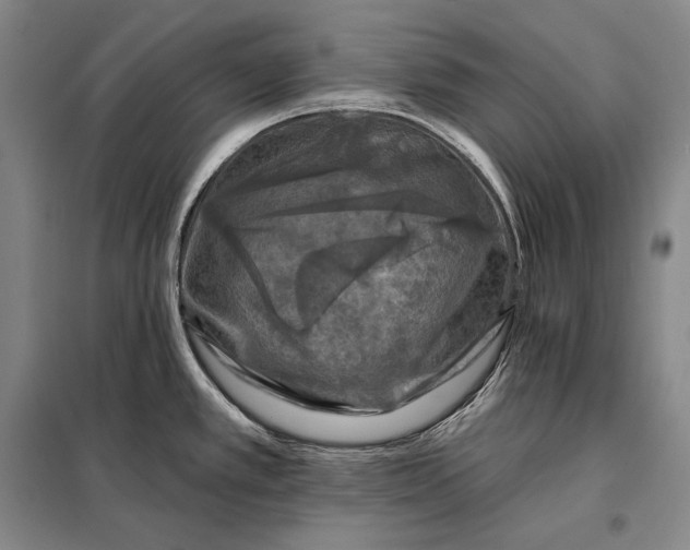 X0000098131389200805011311