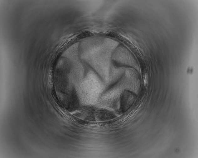 X0000098131396200805011311