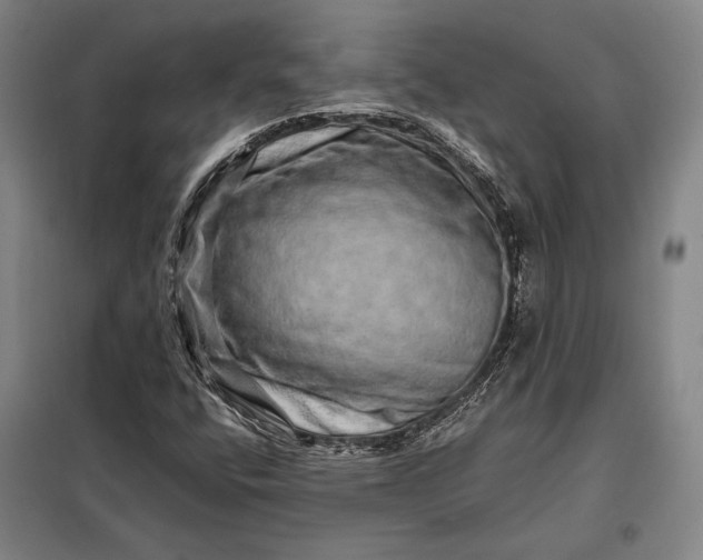 X0000098131400200805011311