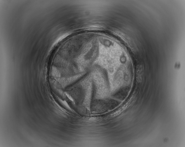 X0000098131402200805011311