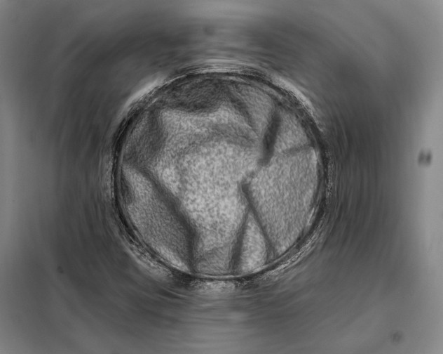 X0000098131403200805011311