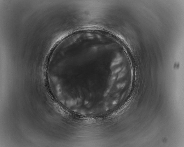 X0000098131405200805011311