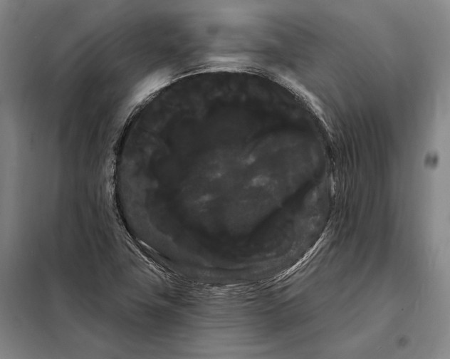 X0000098131411200805011311