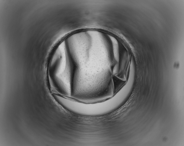 X0000098131416200805011311