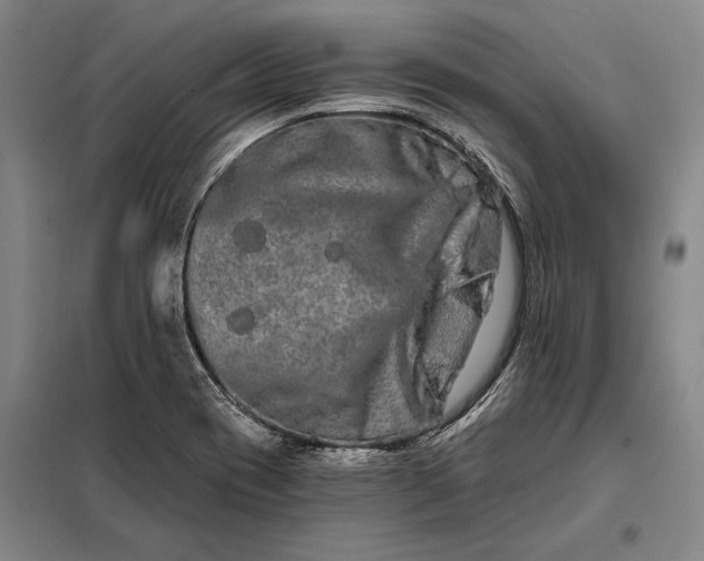 X0000098131417200805011311
