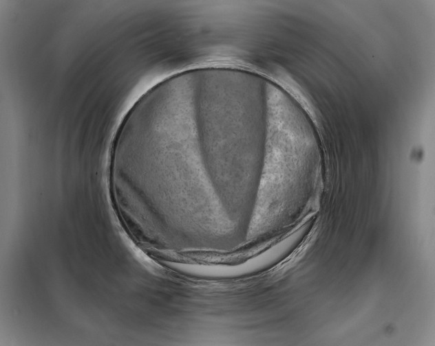 X0000098131438200805011311