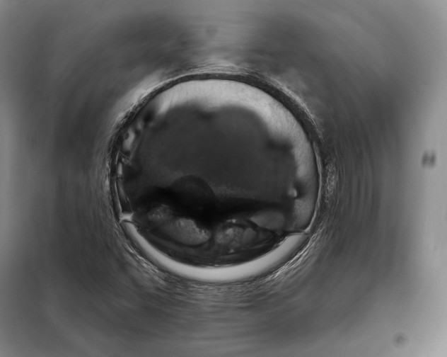 X0000098131455200805011310