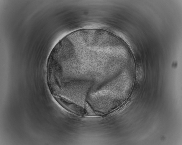 X0000098131487200805011310
