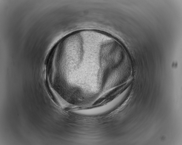 X0000098131509200805011309