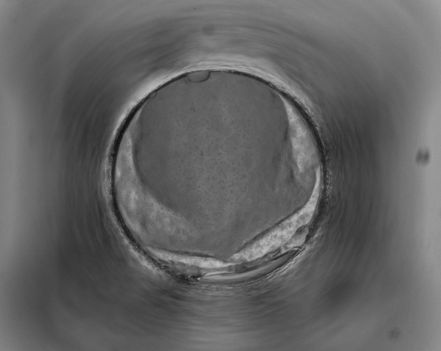 X0000098131517200805011309