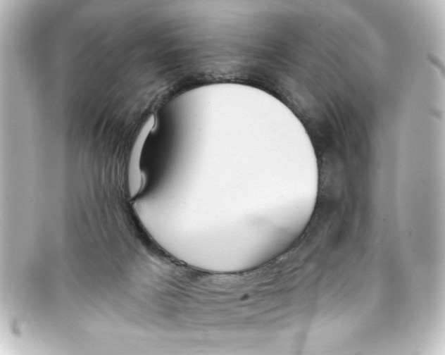 X0000098130025200805081008