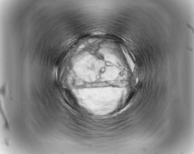 X0000098130047200805081007
