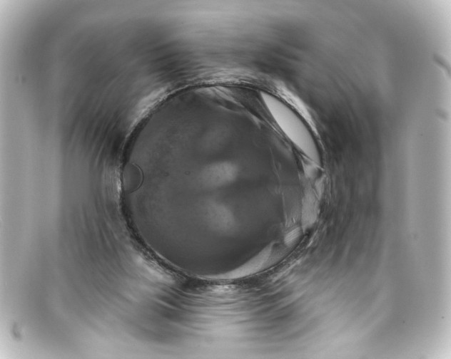 X0000098130059200805081007