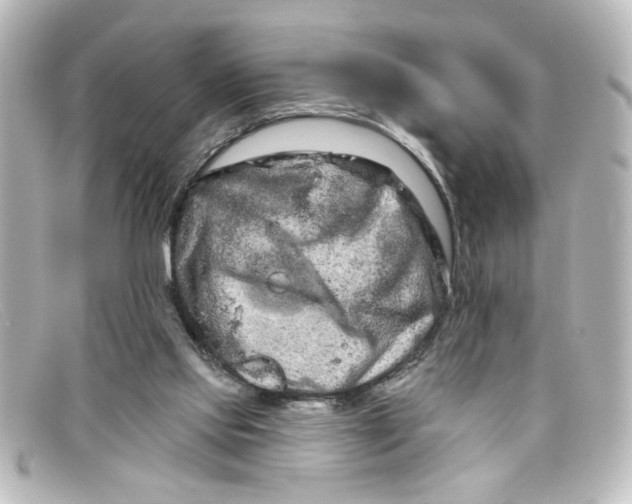 X0000098130061200805081007