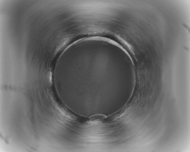 X0000098130067200805081007