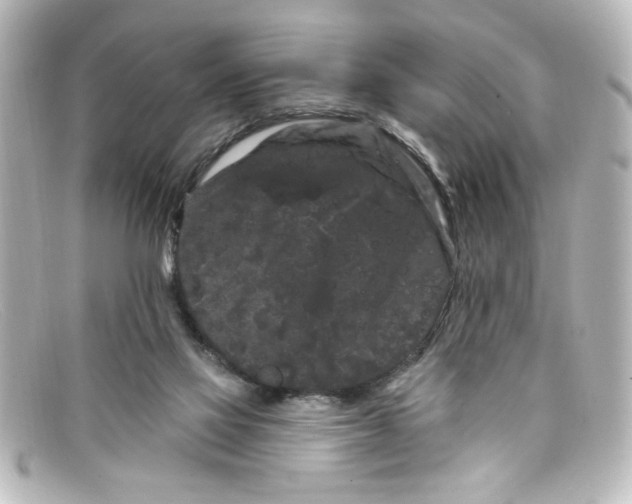X0000098130069200805081007