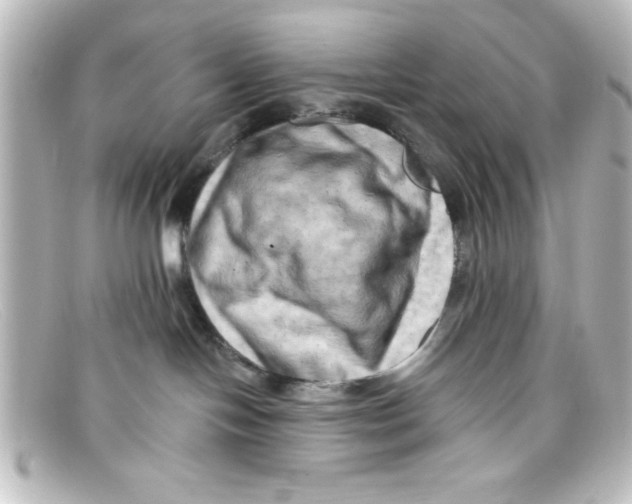 X0000098130094200805081007