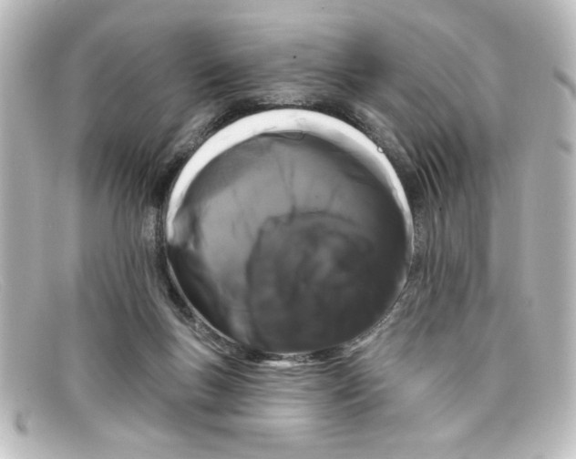 X0000098130167200805081006