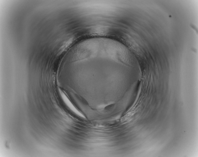 X0000098130168200805081006