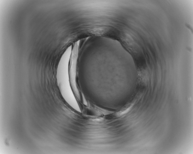 X0000098130237200805081005