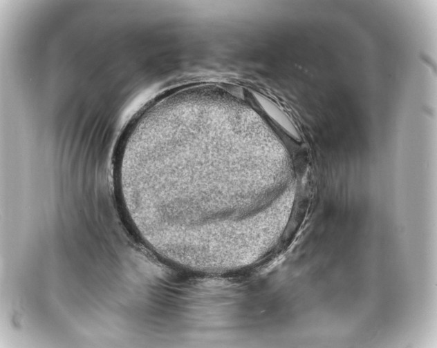 X0000098130246200805081004