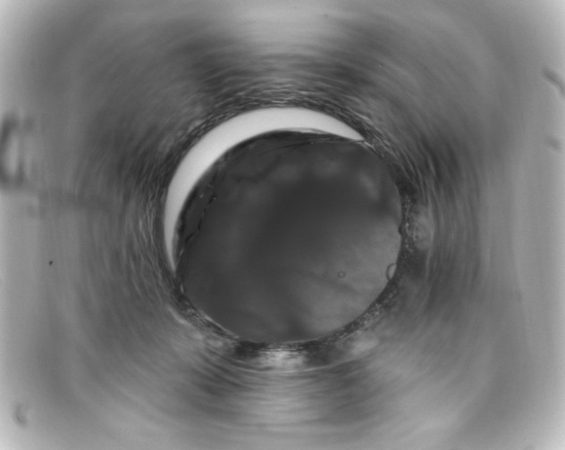 X0000098130319200805081004
