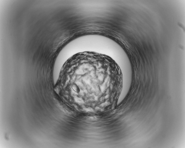 X0000098130411200805081002