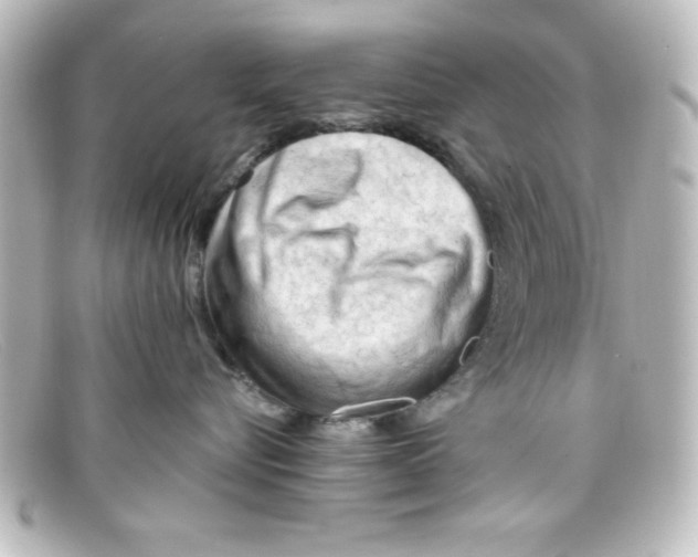 X0000098130576200805081001